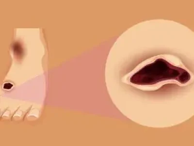 Podologia-Educamundo2-2-1